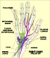 Carpal Tunnel